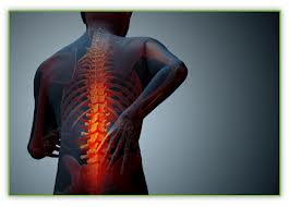 Chiropractic care for back pain after an auto accident injury